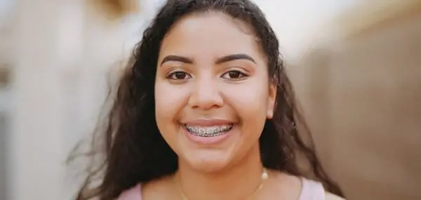 AFTER Braces: Protect Your Investment in That Beautiful Smile