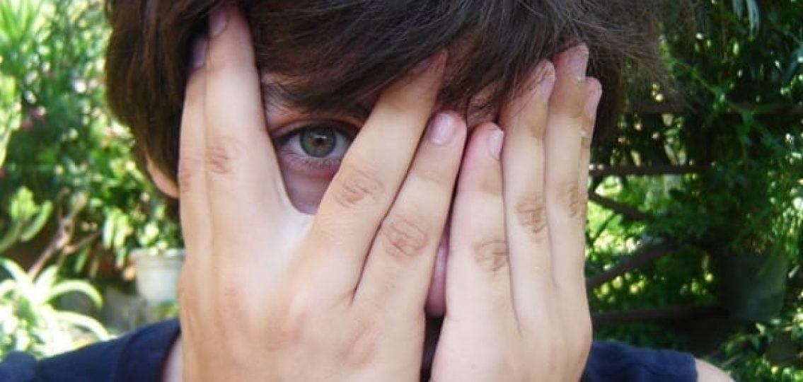 teenage boy covering his face and peaking out through his fingers with a bruise on his face