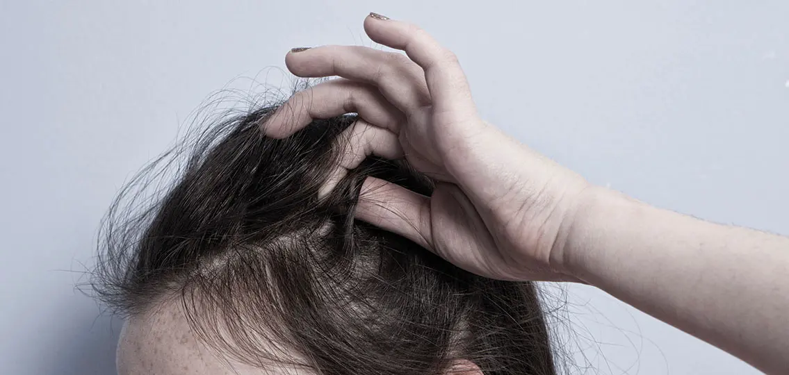 trichotillomania disorder girl pulling out her hair