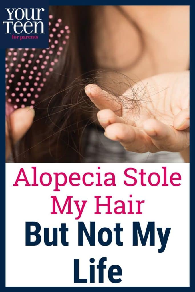 Teenage Alopecia Stole My Hair.  It Didn’t Steal My Life.