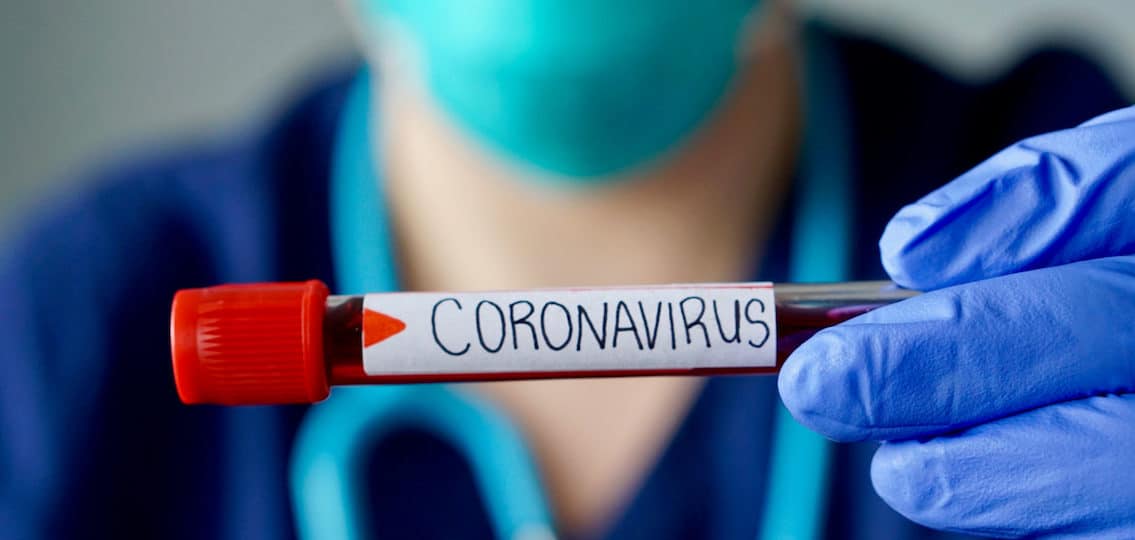doctor holding a vial labled coronavirus