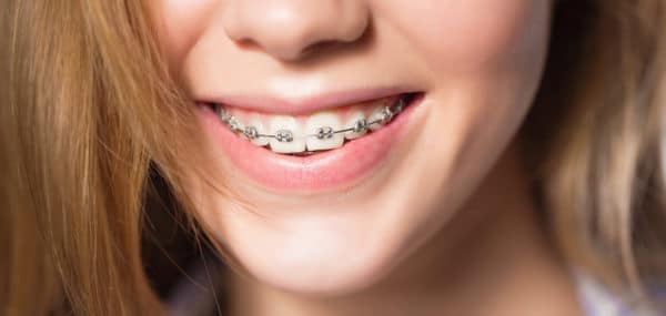 Frequently Asked Questions for the Orthodontist