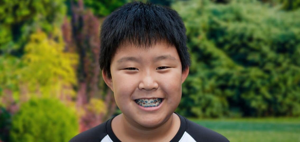 a smiling teen boy in his backyard showing off his braces