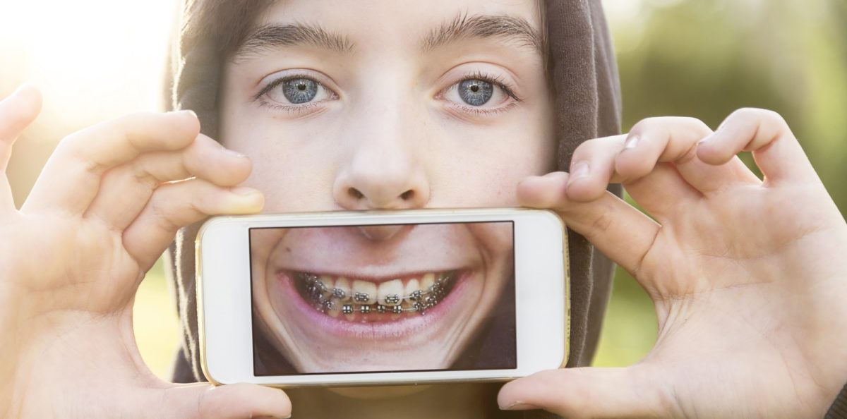 Can Dentists Tell if Your Teen Vapes? The Answer is Surprising